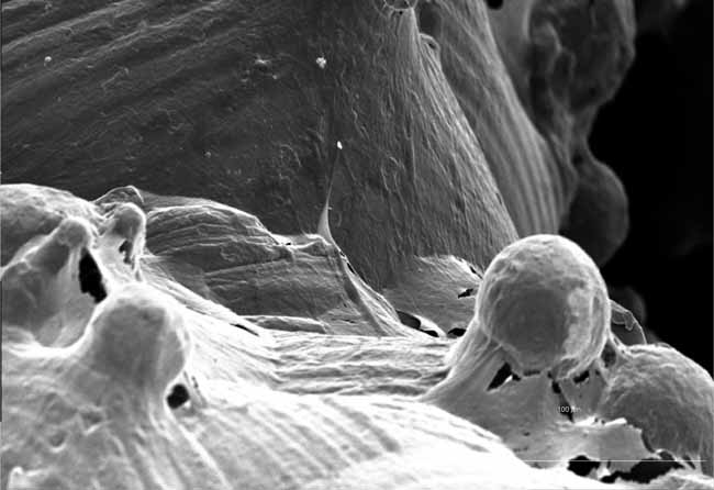 WNT16, prodotta dagli osteoblasti, inibisce l’osteoclastogenesi e previene le fratture da fragilità ossea corticale