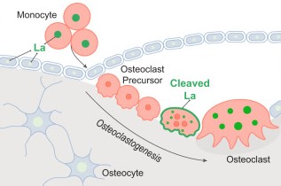 La proteina di superficie “La” regola la fusione degli osteoclasti