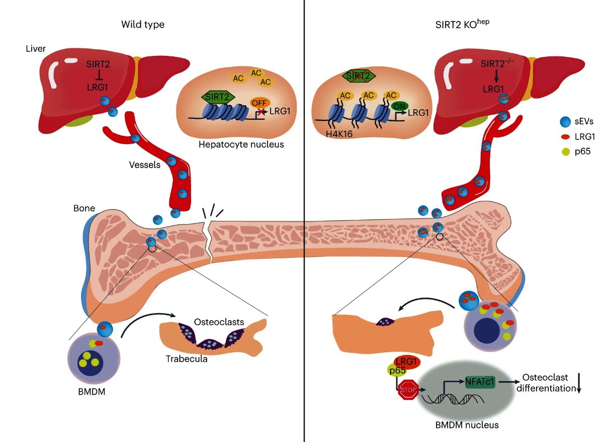 Crosstalk osso-altri organi: SIRT2 alla base dell’interazione Fegato-Osso
