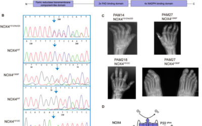 Nuove varianti rare del gene NOX4 coinvolte nel differenziamento degli osteoclasti