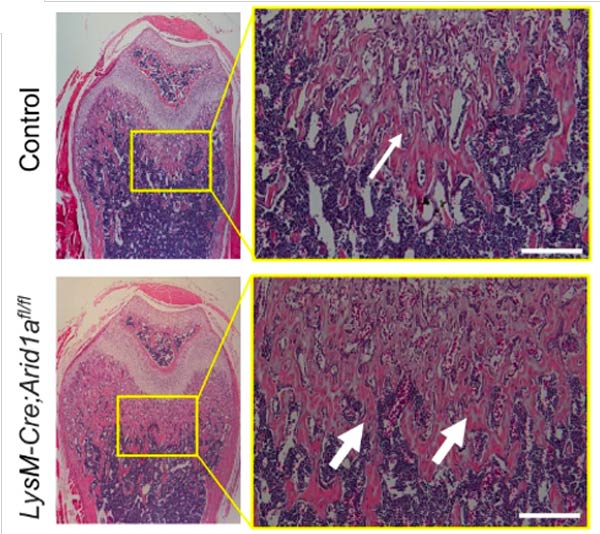 ARID1A: il guardiano del differenziamento degli osteoclasti