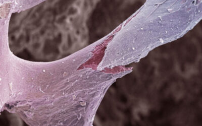 Sicurezza ed efficacia delle terapie sequenziali nell’osteoporosi post-menopausale