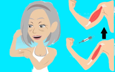La vitamina D nella sarcopenia