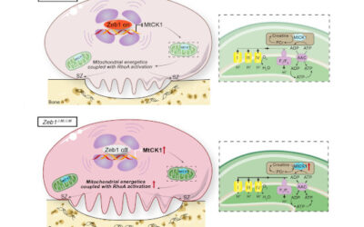 fattore trascrizionale Zeb1 regola l’attivazione degli osteoclasti e il rimodellamento scheletrico