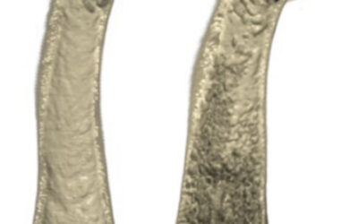 Il ruolo della proteina Slc37a2 negli osteoclasti e nel metabolismo osseo