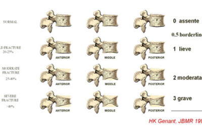 Documento condiviso SIRM – SIOMMMS – OFF Italia “Valutazione strumentale dell’osteoporosi”